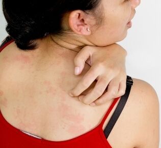 granulomas in the body symptoms of the presence of parasites