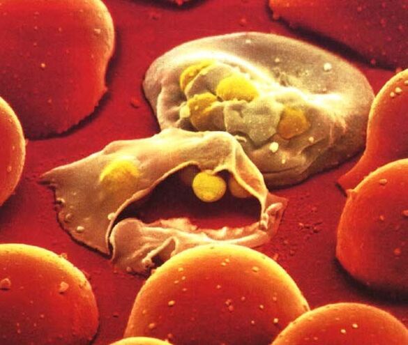 the simplest malaria parasite plasmodium