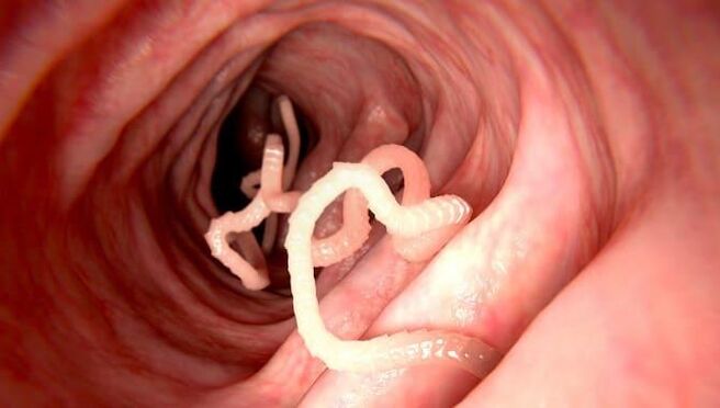 Worms that live in human intestines. 