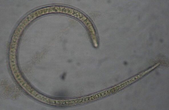 Trichinella is a parasitic protostome round worm
