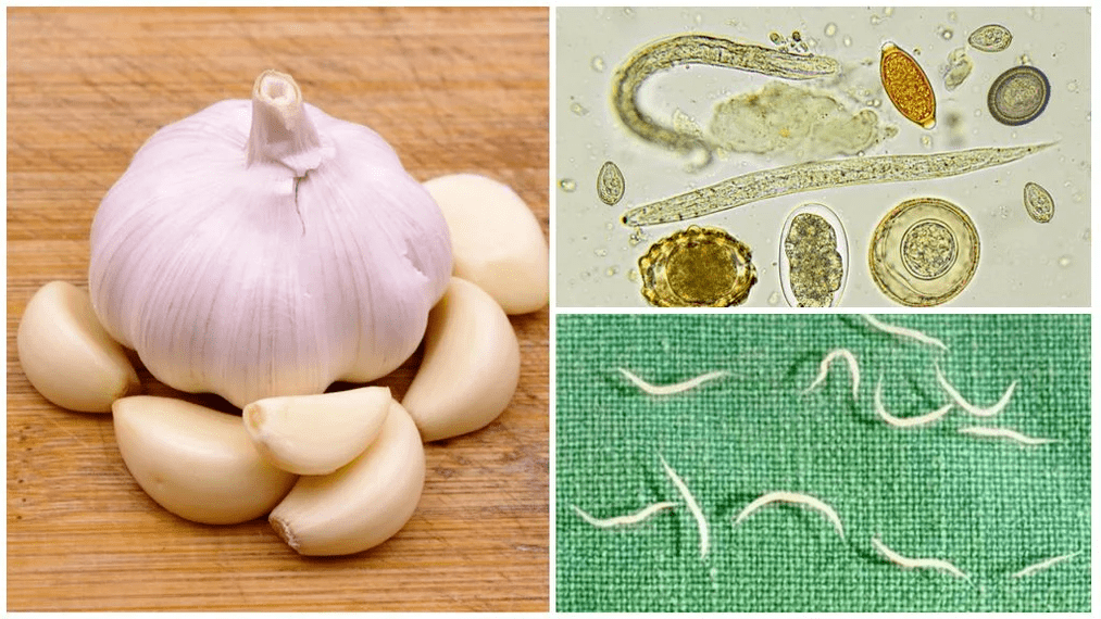 Parasites in the body popular methods