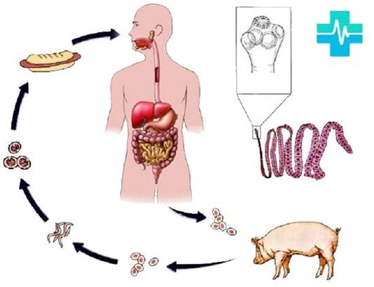 Forms of infection